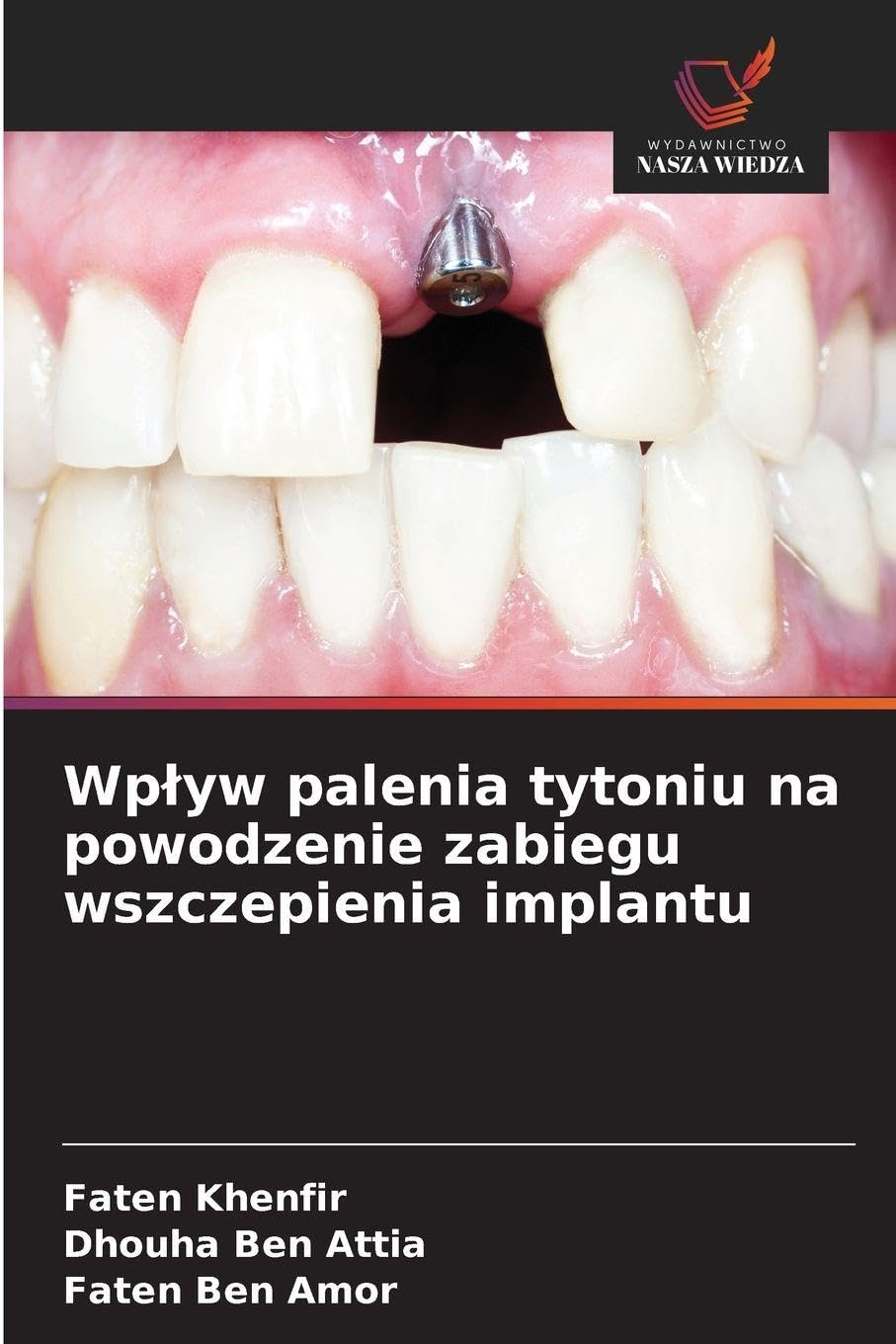 Wp¿yw palenia tytoniu na powodzenie zabiegu wszczepienia implantu