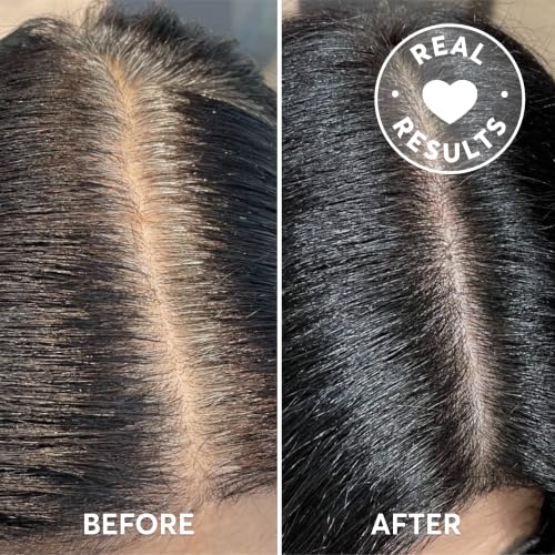 Image of Madison Reed Root Perfection Root Touch Up Kit for T-Zone - 3N Corato Black, 2 Permanent Applications, 100% Gray Coverage in 10 Min | PPD-Free & Ammonia-Free, Includes Hydrating Hair Mask