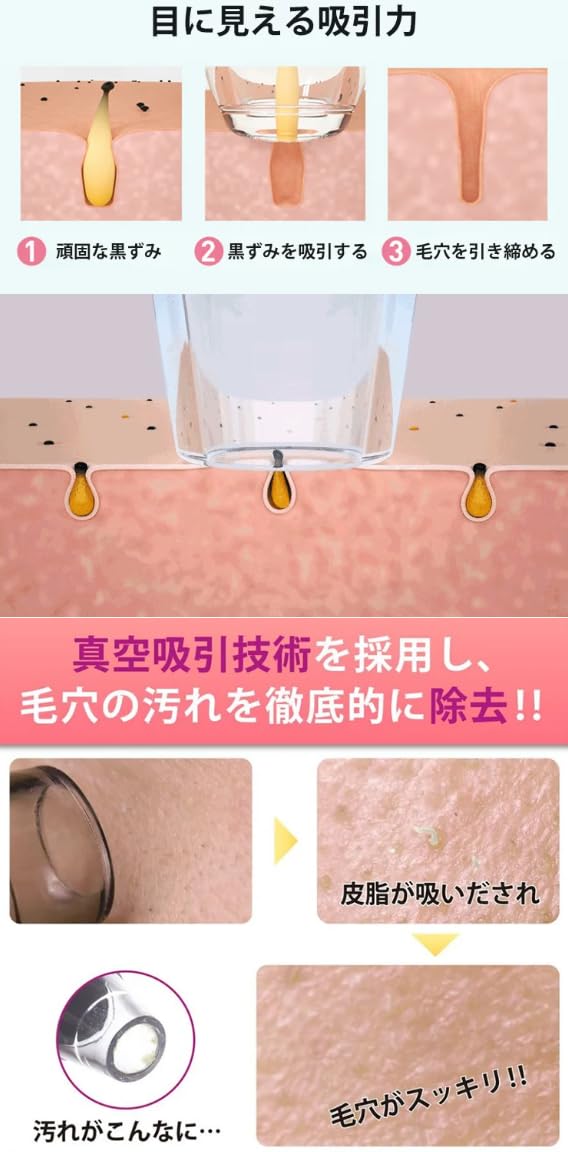 Amazon.co.jp: 毛穴吸引器 2025年新型 カメラ内蔵毛穴洗浄器（角栓
