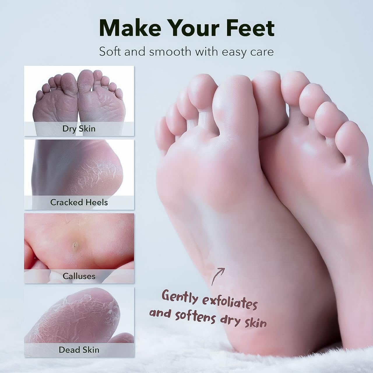 Venvintra Foot Peeling Mask β Exfoliating Foot Mask for Removing Dead Skin, Softening Heels & Repairing Cracked Feet 2