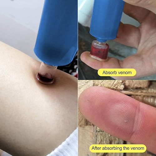 Miniatura 5 de Kit de mordida de serpiente, kit de picadura de abeja, suministros de primeros auxilios de emergencia, bomba de succión para extractor de veneno,