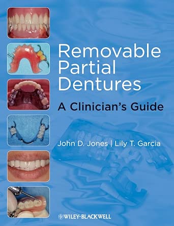 Removable Partial Dentures: A Clinician's Guide-Wow! eBook