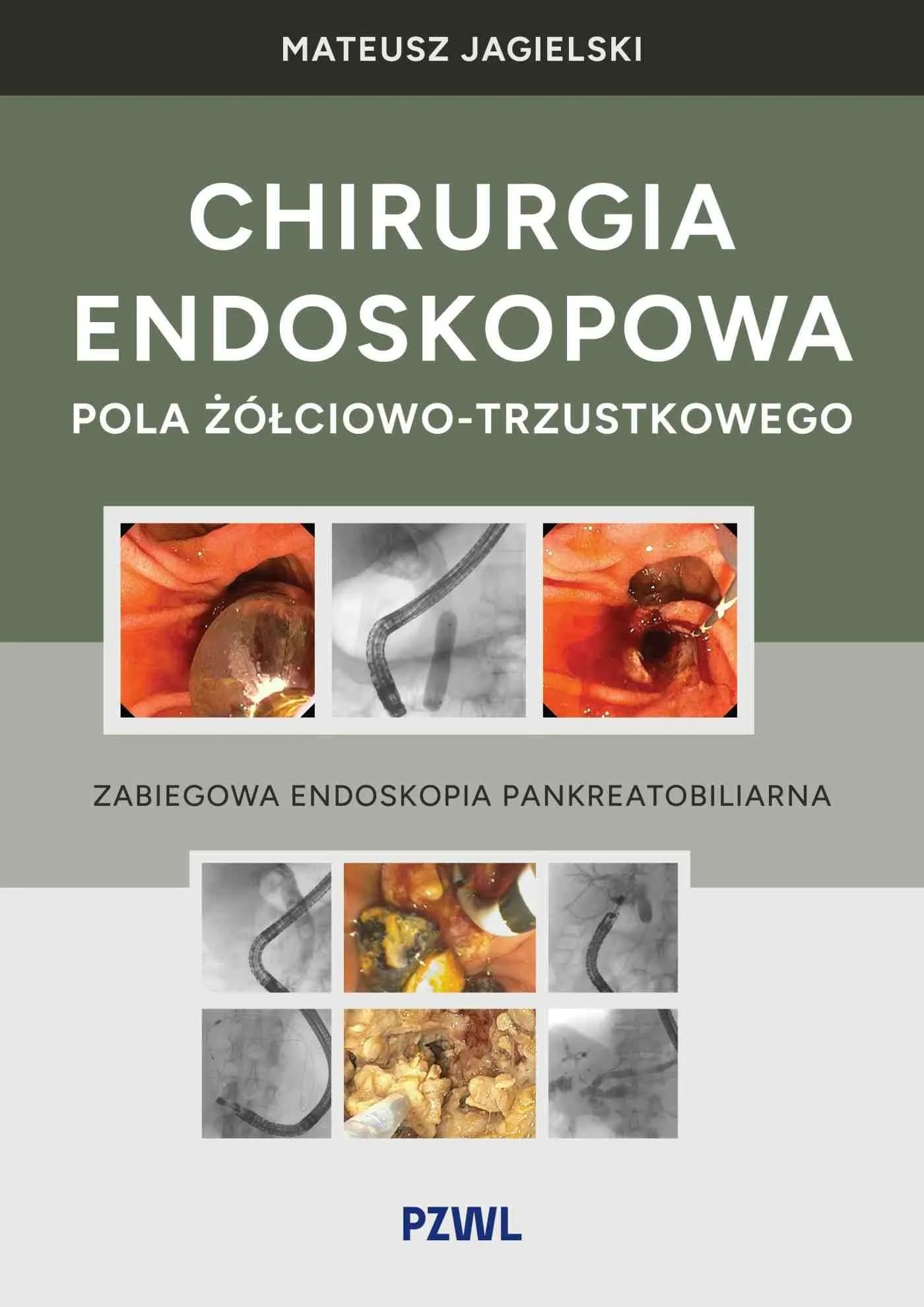 Chirurgia endoskopowa pola żółciowo-trzustkowego