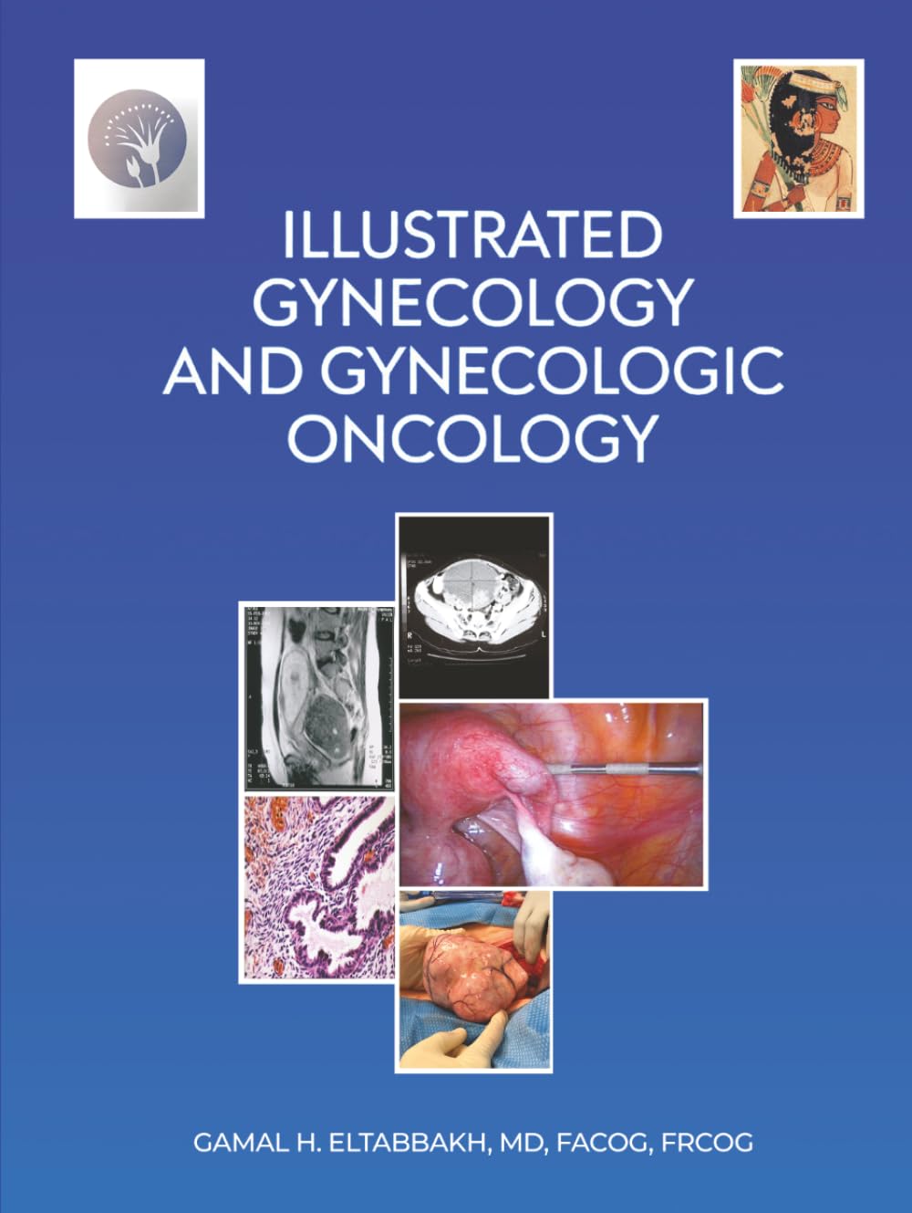Illustrated Gynecology & Gynecologic Oncology