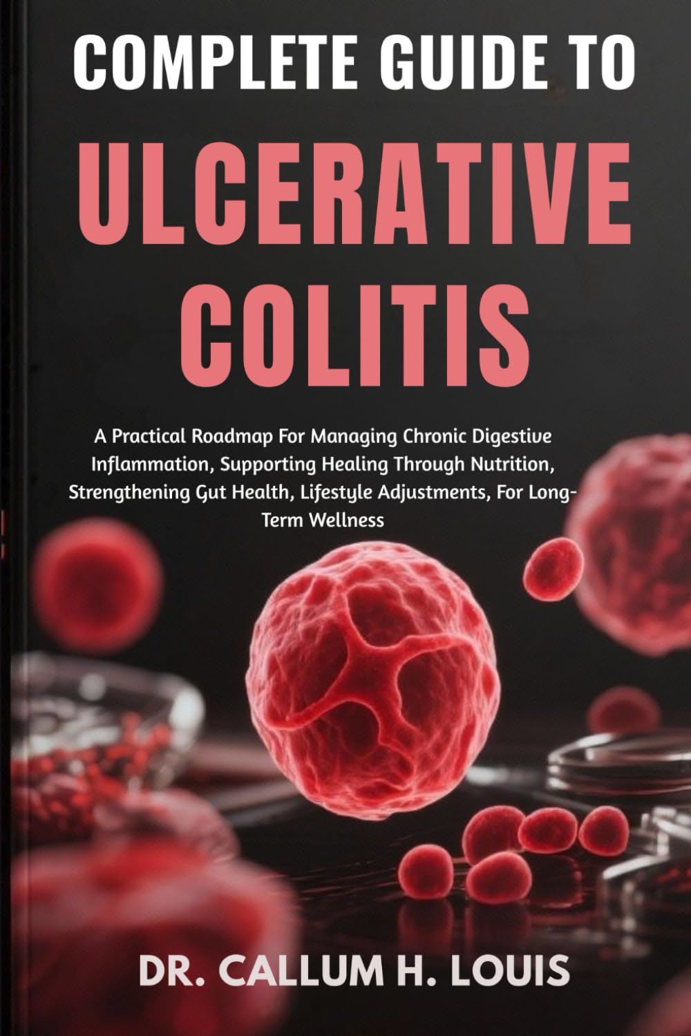 COMPLETE GUIDE TO ULCERATIVE COLITIS: A Practical Roadmap For Managing Chronic Digestive Inflammation, Supporting Healing Through Nutrition, ... Lifestyle Adjustments, For Long-Term Wellness