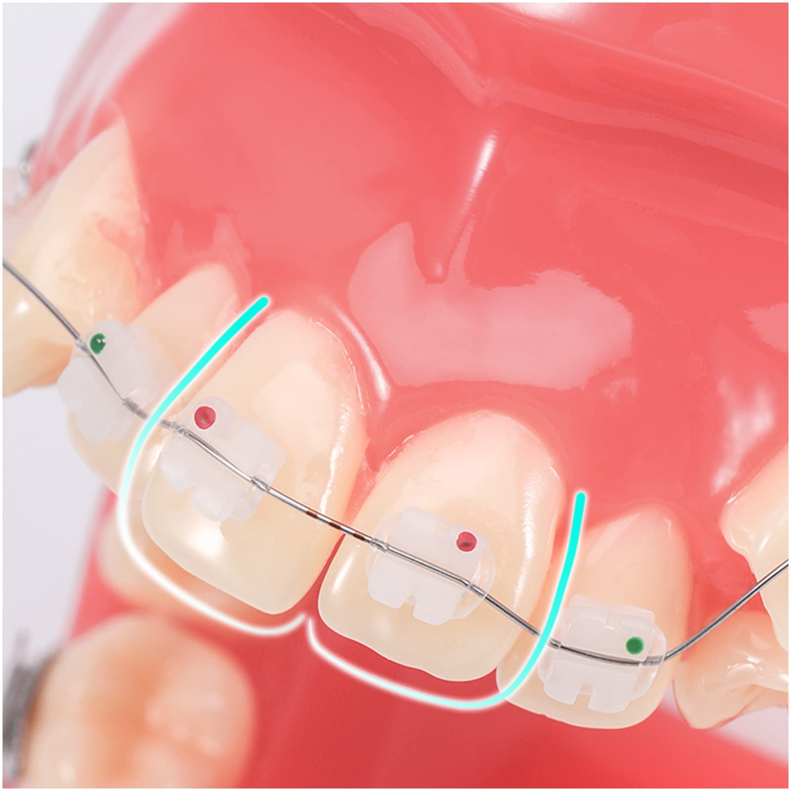 Model zębów dentystycznych-model demonstracyjny ortodoncji-dentystyczny z metalowymi wspornikami model zębów ortodontycznych do celów edukacyjnych nauka narzędzie dydaktyczne(A) (A)