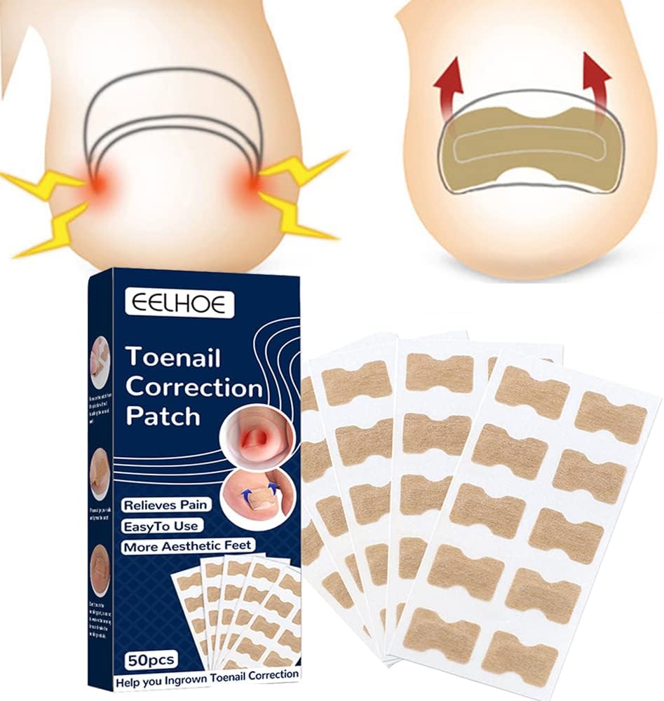 Health Toenail Corrector Patch, Ingrown Toenail Correction Stickers, Witn Nail Correction Tool, Toenail Corrector Patches, Glue-Free Nail Corrector-Patch Pedicure Tools