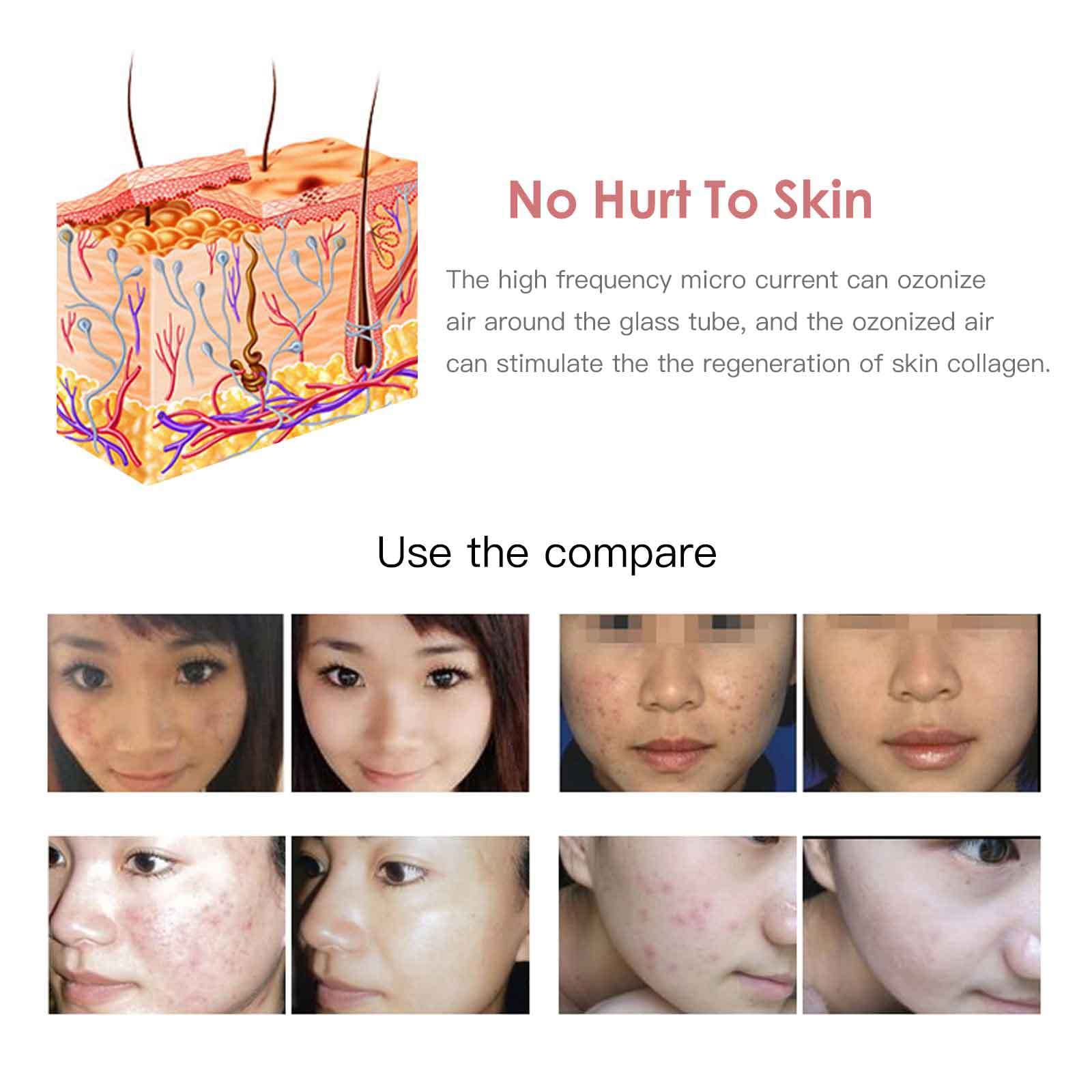 Appareil de beauté portable anti-âge pour soins du visage Outil de beauté Instrument facial
