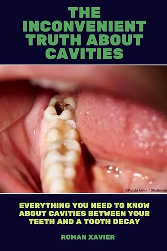 THE INCONVENIENT TRUTH ABOUT CAVITIES: Everything You Need to Know About Cavities Between Your Teeth and a Tooth Decay