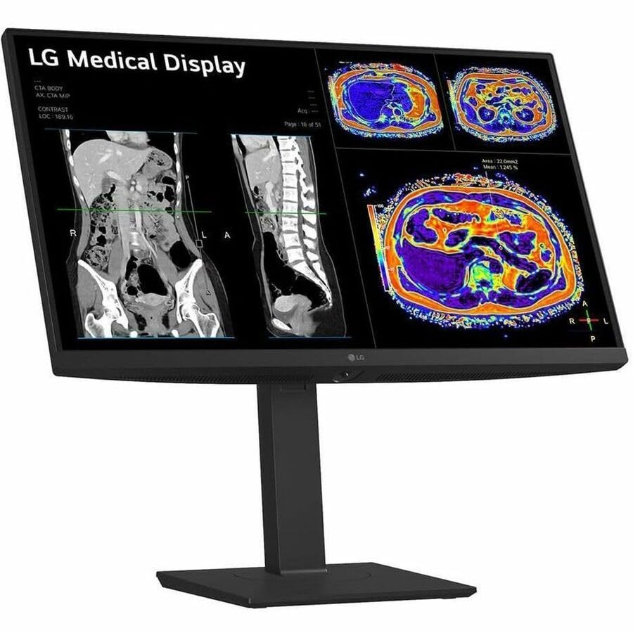 Image of LG 27HS713C-B 27 inch Class Webcam 4K UHD LED Monitor - 16:9 - Black