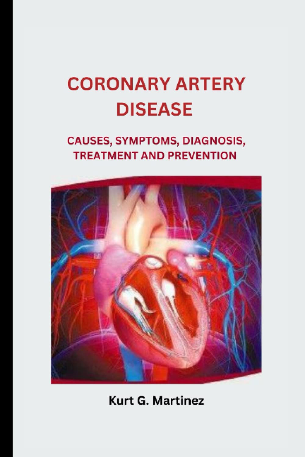 CORONARY ARTERY DISEASE: Causes, Symptoms, Diagnosis, Treatment and Prevention