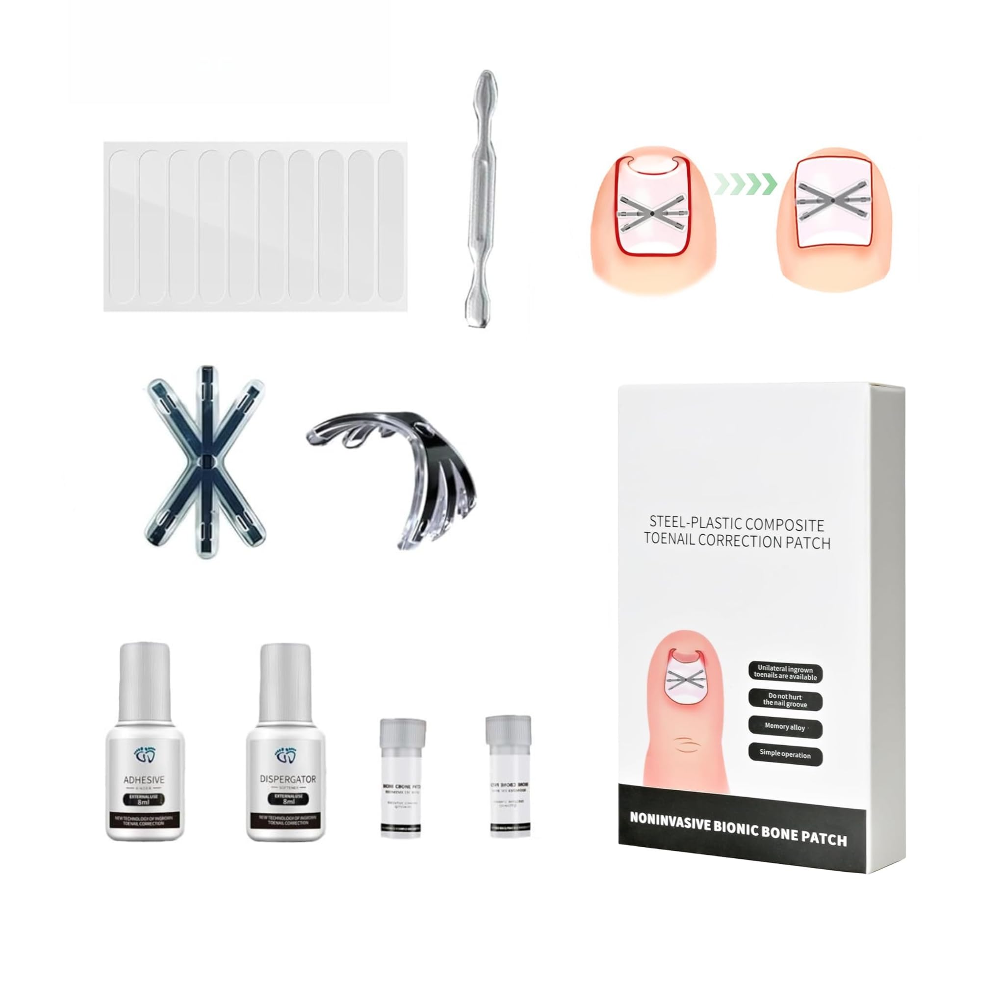 Titanium Alloy Ingrown Toenail Treatment 3X Stronger Pulling Force, Nail Tools and Ingrown Toenail Repair Kit for Curved & Thick Nails, Professional Foot Care Solution for Men & Women (0.63/0.67 in) 0.63-0.67in