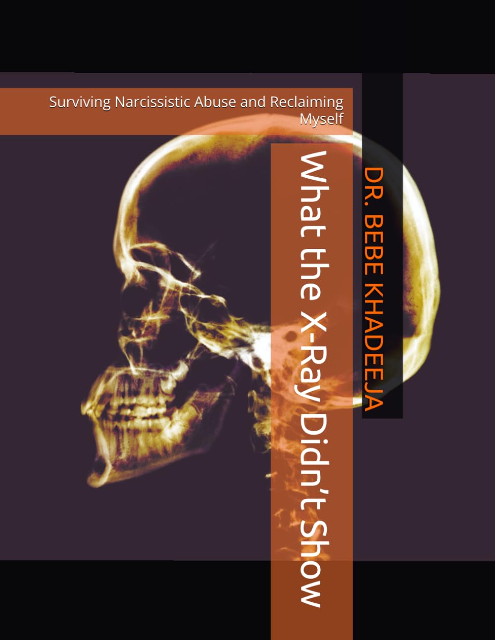 What the X-Ray Didn’t Show: Surviving Narcissistic Abuse and Reclaiming Myself