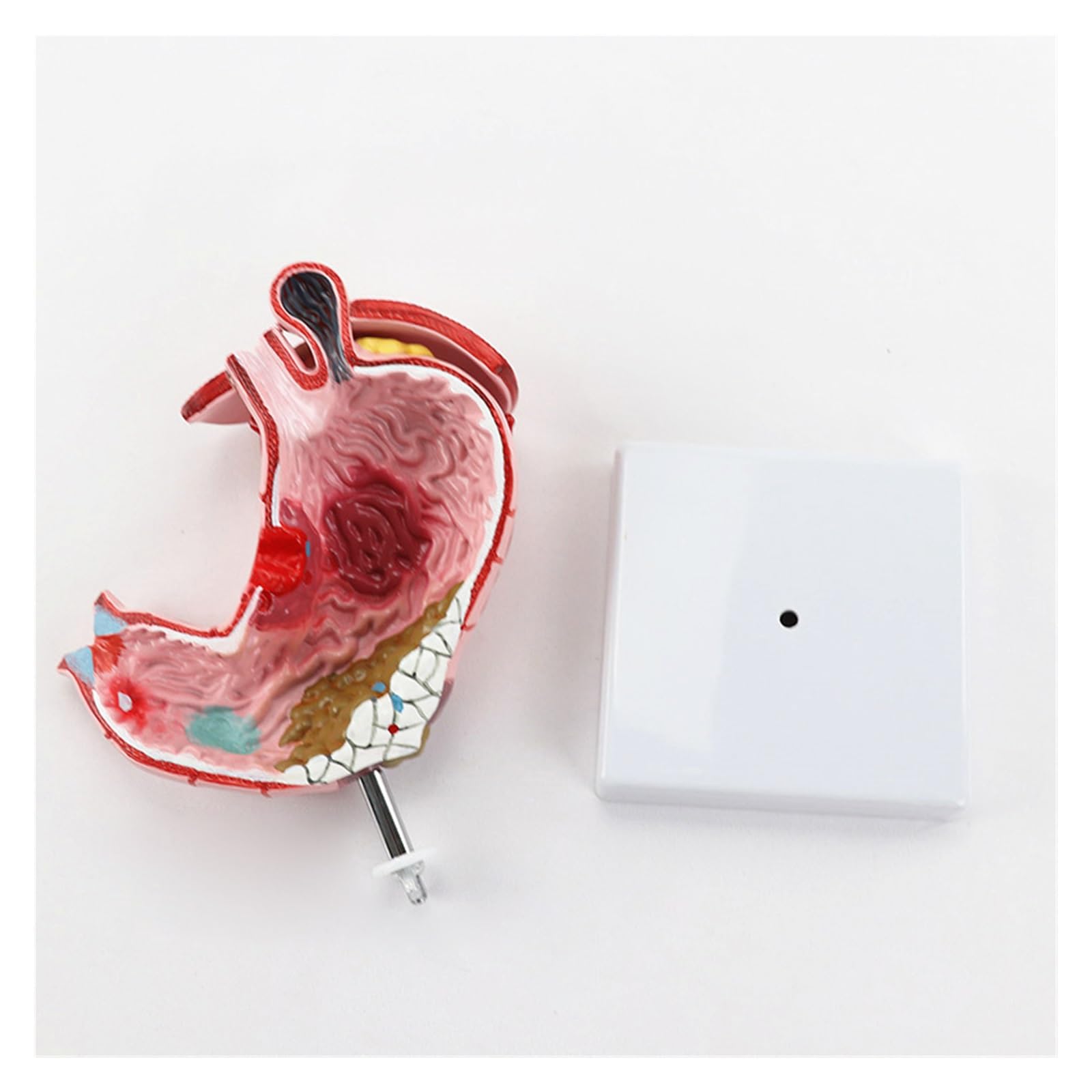 Humano EN Anatomía estomacal patológica Modelo de demostración del estómago Ayuda médica SIDA
