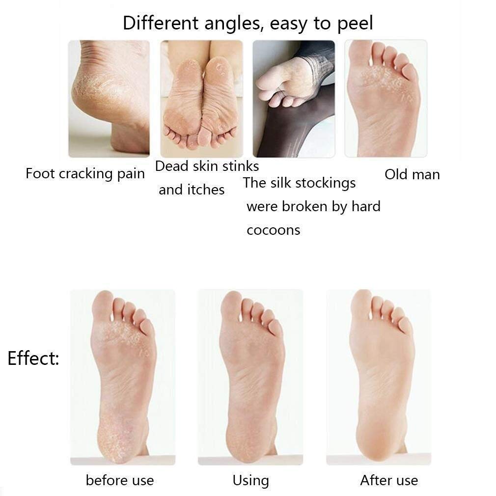 Lima Eléctrica Pies, Pedicura Profesional Lima Durezas Pies Recargable, Aparato de Pedicura Pies Eliminar Callos Pies Cuidado Lima