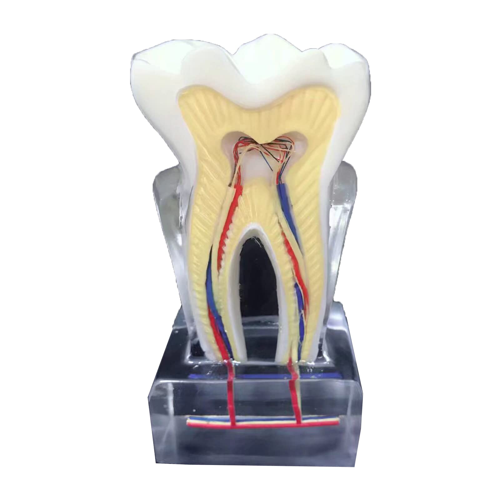 6 modèles de profil dentaire – Modèle d'étude – Modèle d'affichage dentaire – Modèle anatomique des dents – Instrument d'enseignement clair – Pour communication médecin-patient