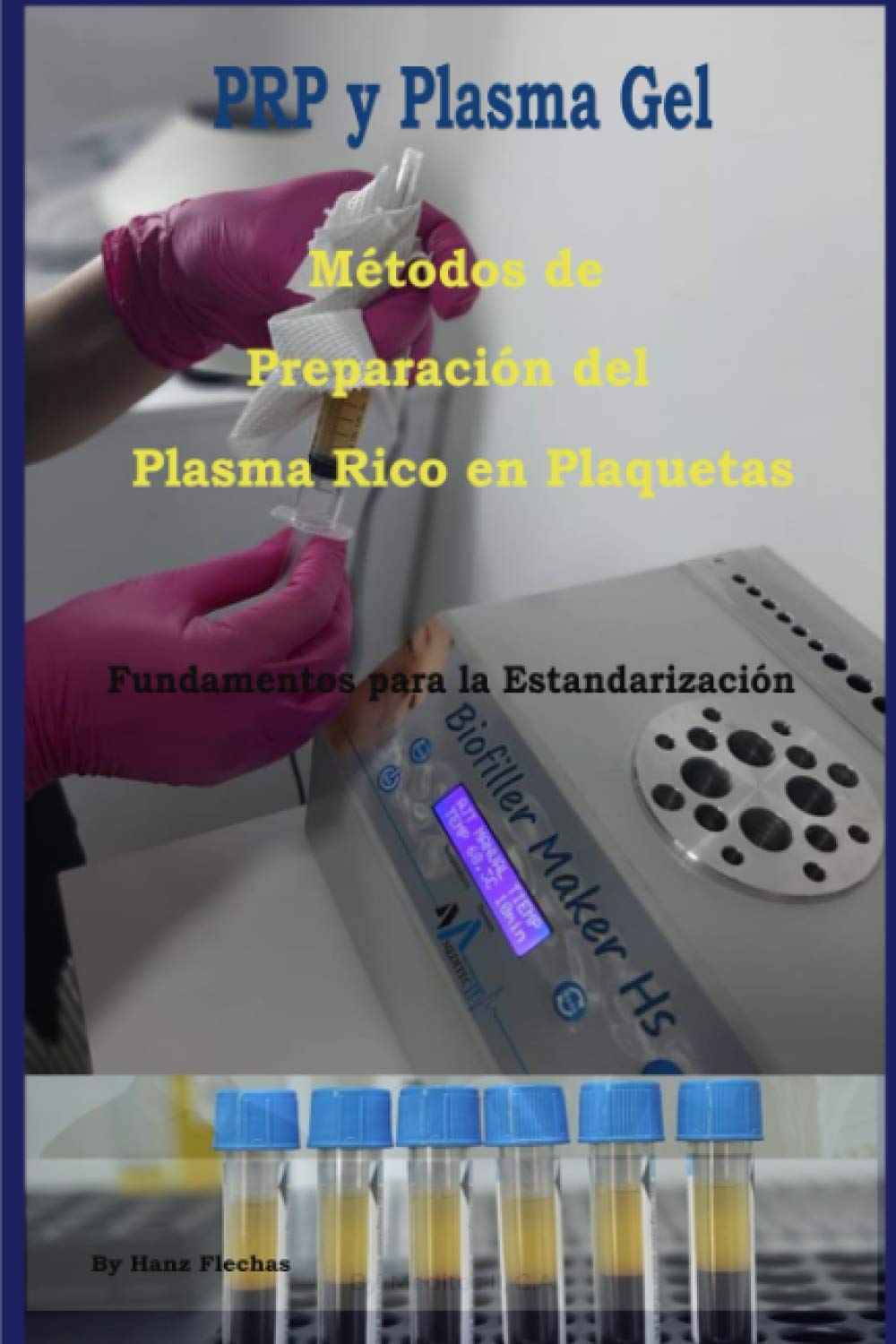 Métodos de Preparación del Plasma Rico en Plaquetas: Fundamentos para la Estandarizacion (PRP y Plasma Gel) (Spanish Edition)