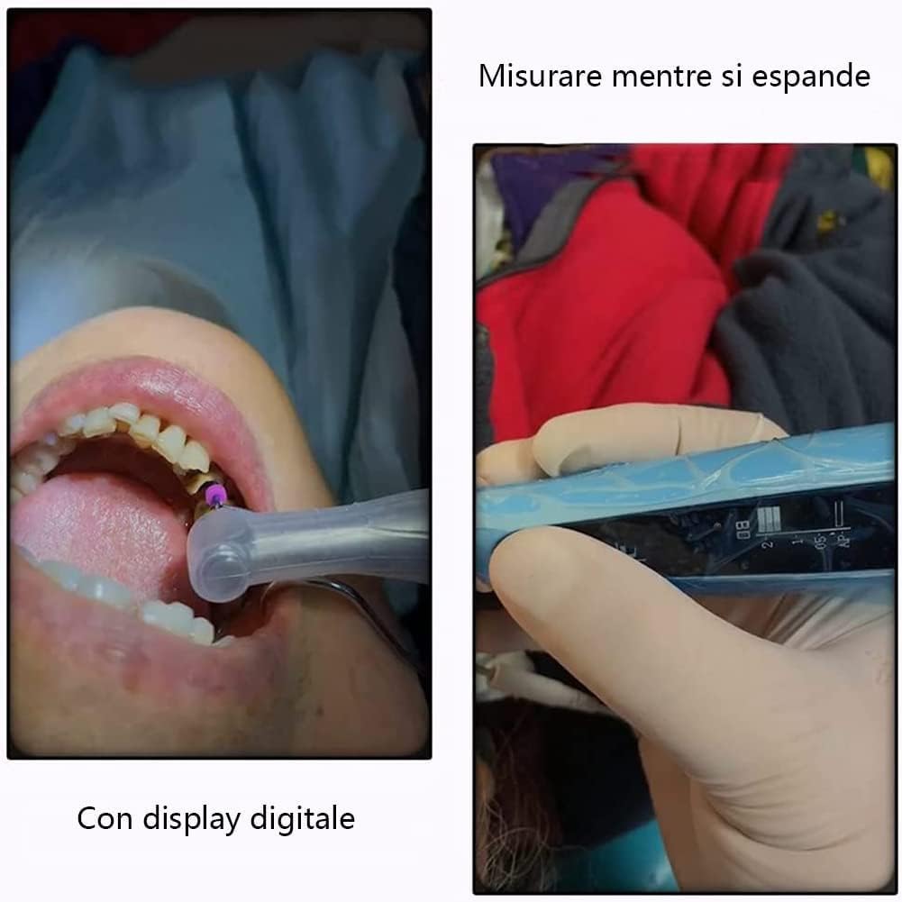16:1 Trattamento Senza Fili del Canale radicolare endodontico, Trattamento Dentale del Motore Endo del LED