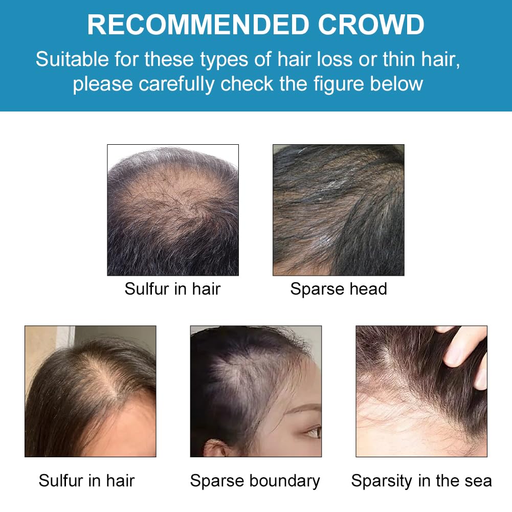 Professional Quality Hair Building Fibers, Nature Keratin Hair Fibers Instantly Full Hair - Image 4