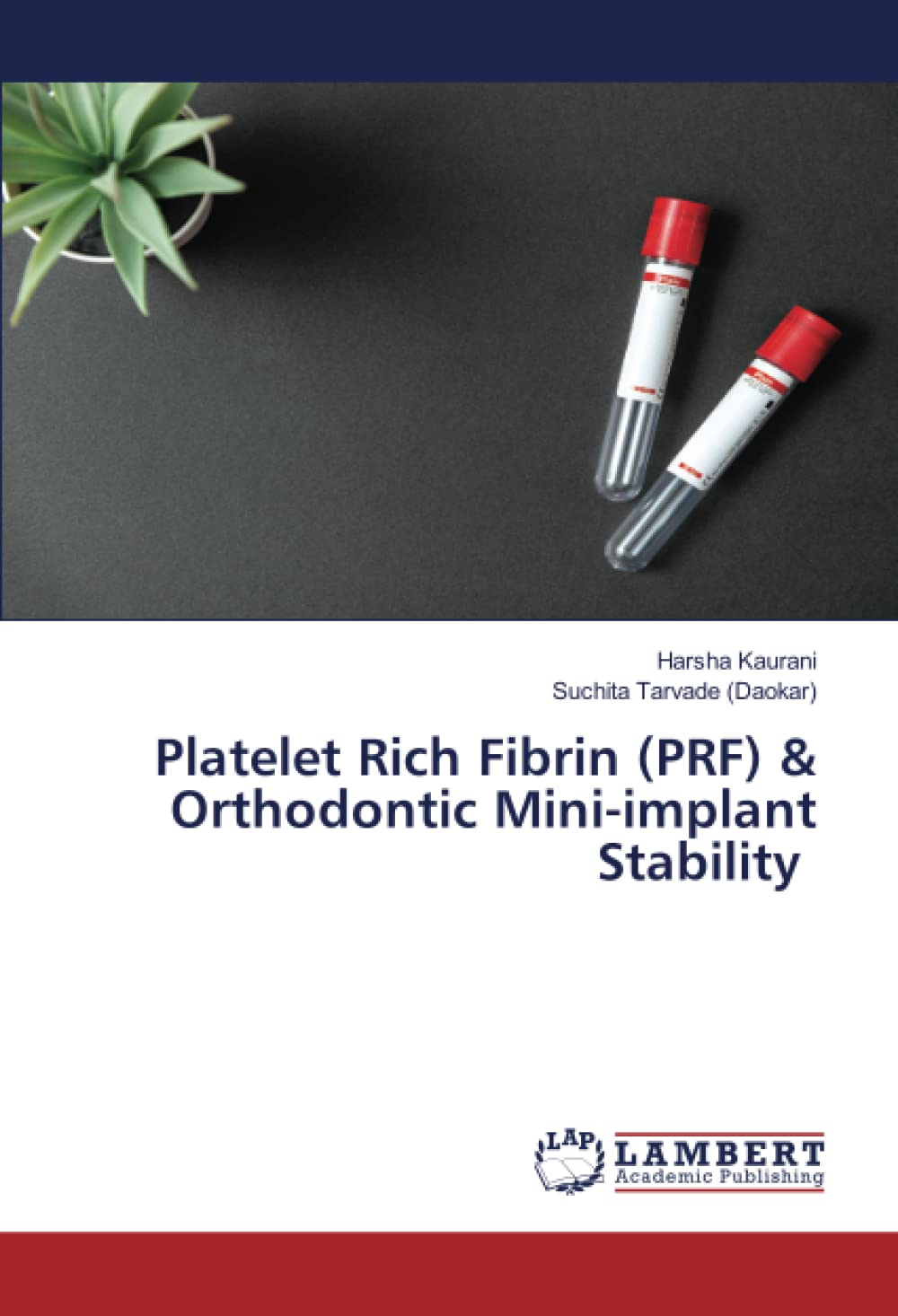 Platelet Rich Fibrin (PRF) & Orthodontic Mini-implant Stability