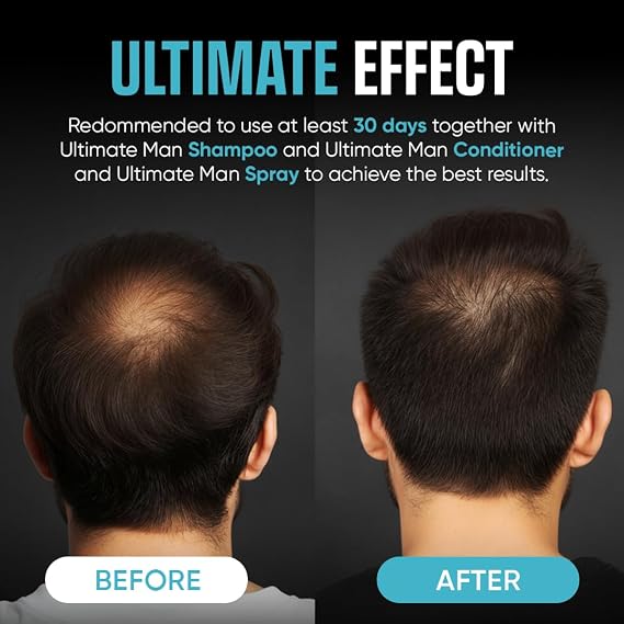 Moerie Ultimate Men Hair Boost Shampoo, Conditioner and Spray for Men, Hair Loss Solution with Biotin and Rosemary, Thickening Hair Regrowth Set with Serum Level Care for Thinning Hair