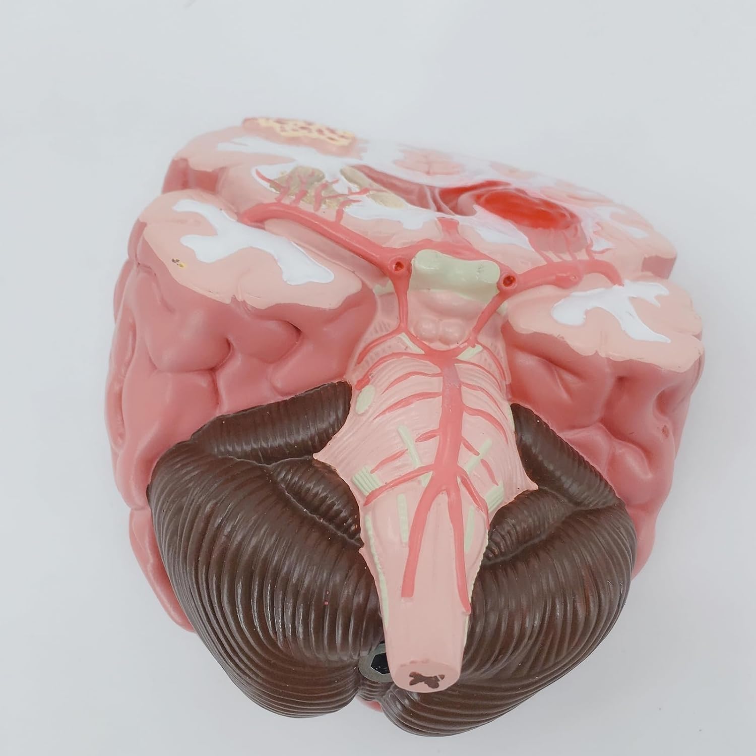 Human Brain Anatomical Model, Cerebral Hemorrhage Cerebral Arteriovenous Malformation Pathological Model, Neurology Medical Teaching Aid, Used for Research and Display