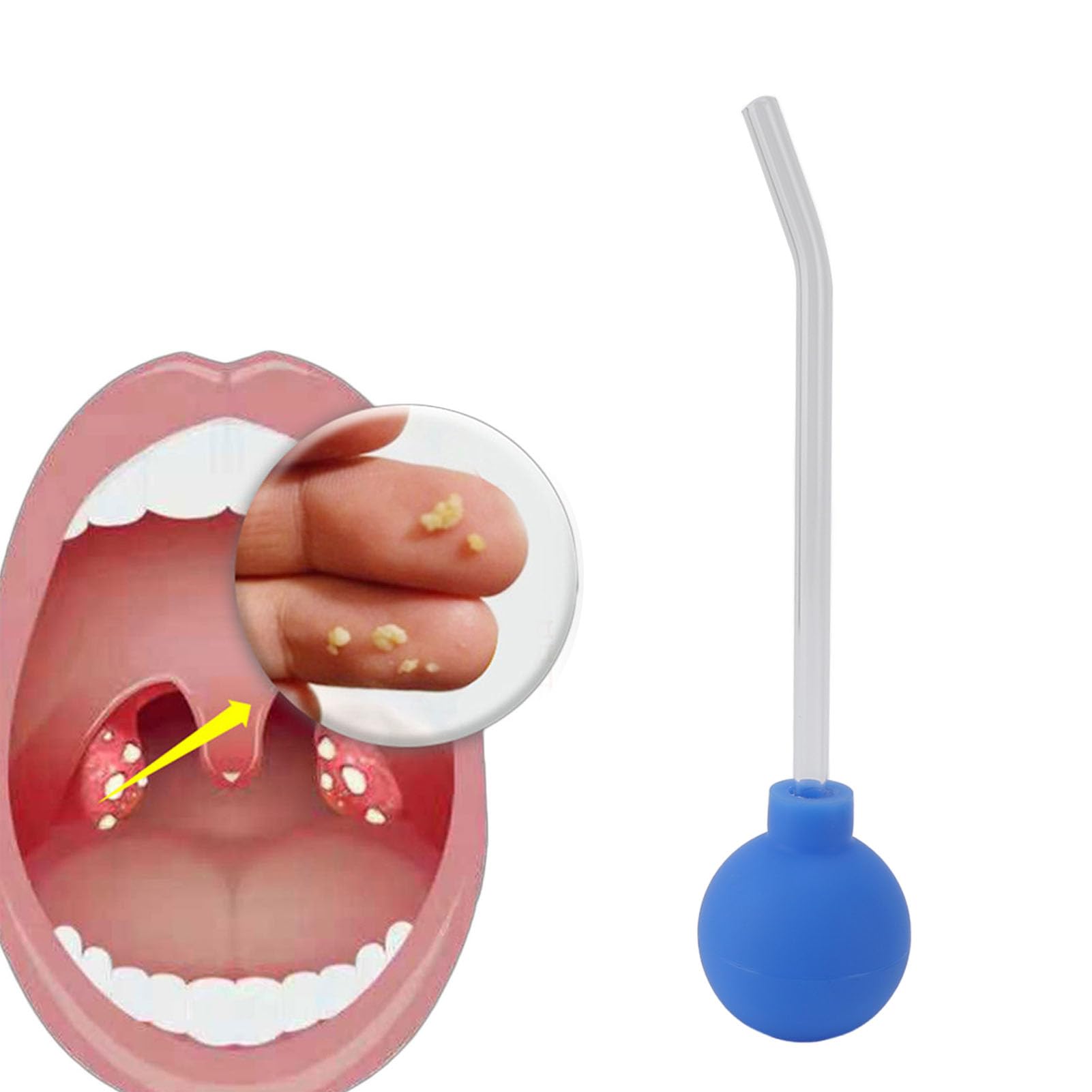 Tonsil Stone Remover,Tonsil Stone Remover Vacuum for Bad Breath Treatment,Tonsil Stone Suction Tool,Bad Breath Treatment for Adults,Throat Suction Tube Mouth Cleaner (Blue)