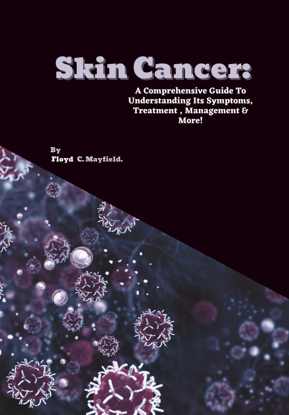 Skin Cancer: A Comprehensive Guide To Understanding Its Symptoms, Treatment , Management & More! (Cancer Decoded)