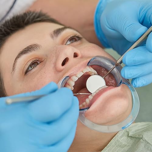 Miniatura 5 de Zhengmy 100 piezas de retractor de mejillas blanqueamiento dental en forma de C, abridor de boca, retractor de boca para blanqueamiento de dientes