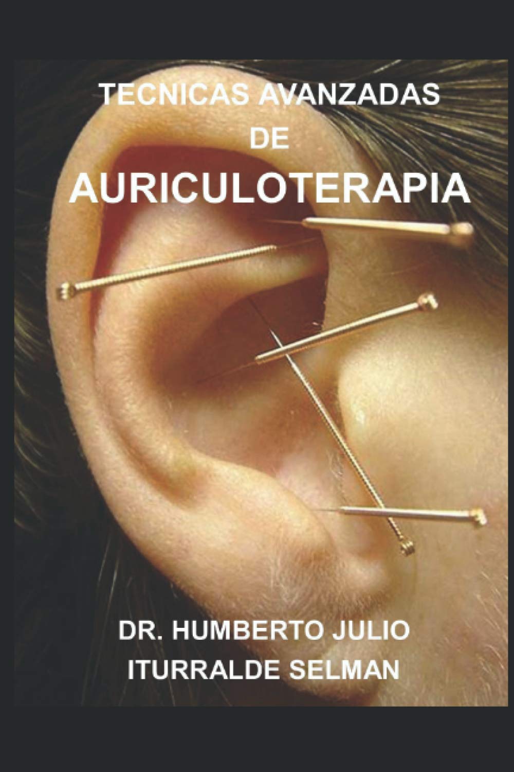 TECNICAS AVANZADAS DE AURICULOTERAPIA