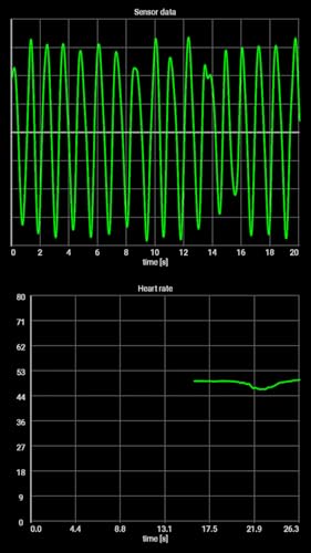 Recovery Heart Rate