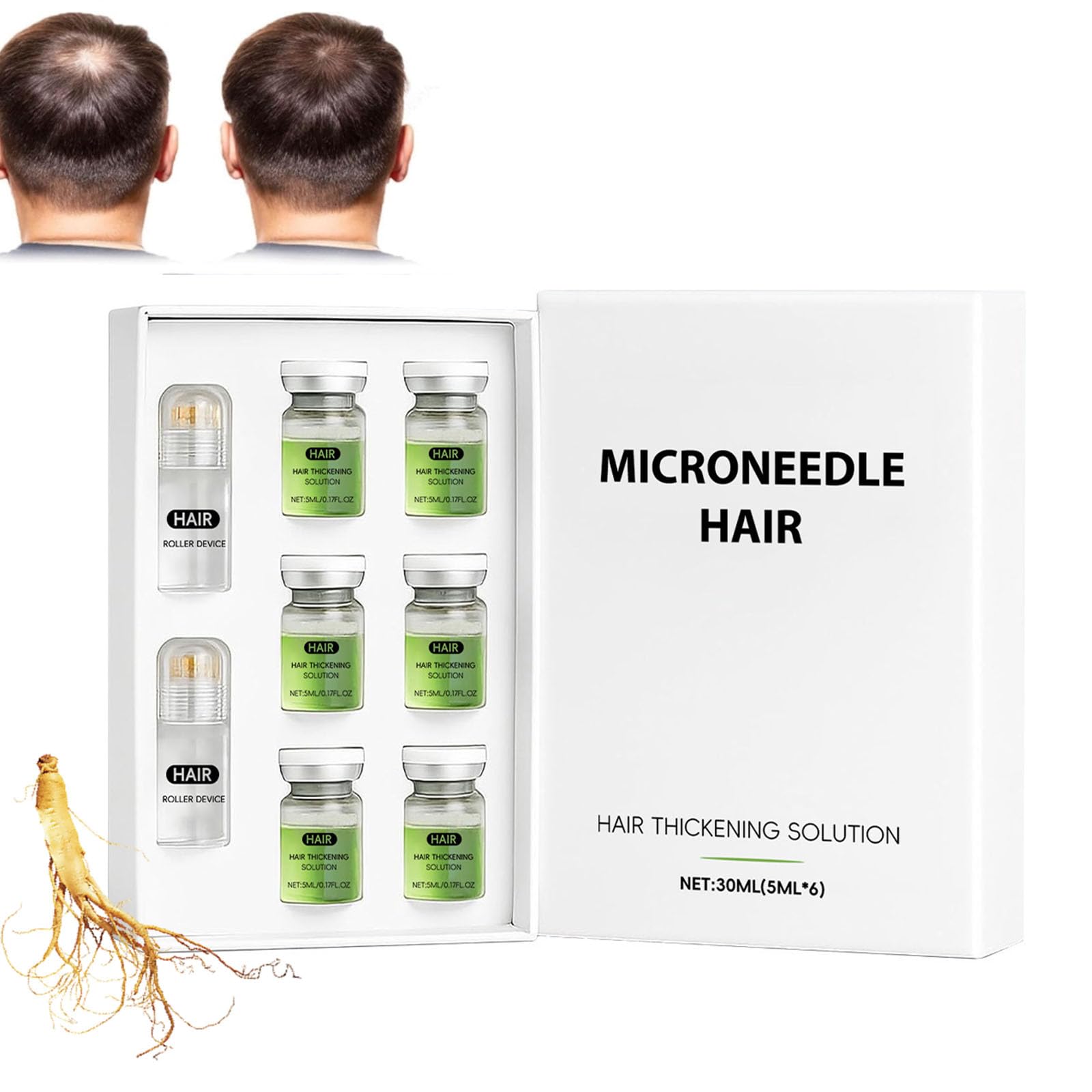 Système de repousse des cheveux Alphainfuse, traitement avancé de croissance des cheveux, sérum de croissance des cheveu-x micro-aiguilles, traitement pour plus épais, renforce les racines (1PC)
