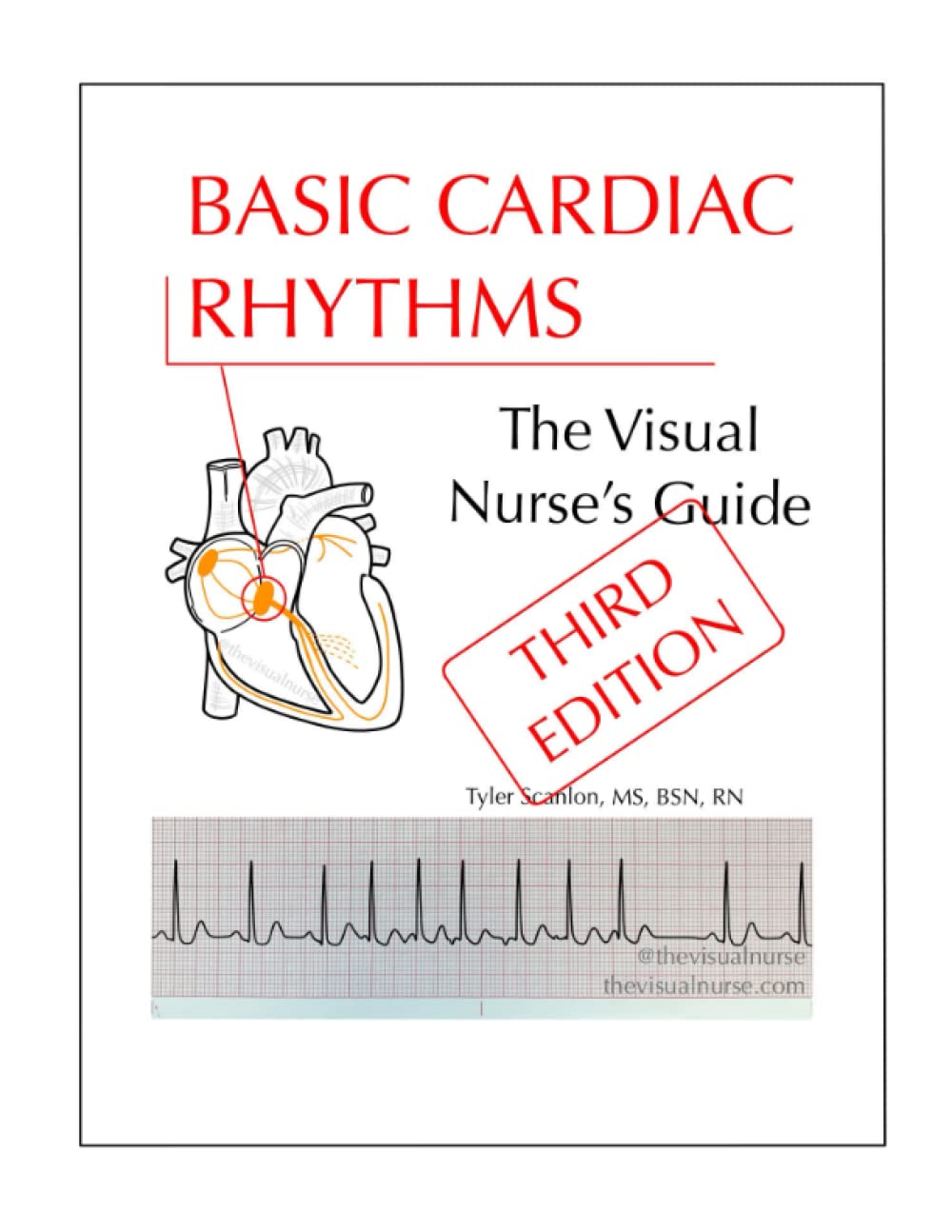Basic Cardiac Rhythms: The Visual Nurse's Guide 3RD EDITION
