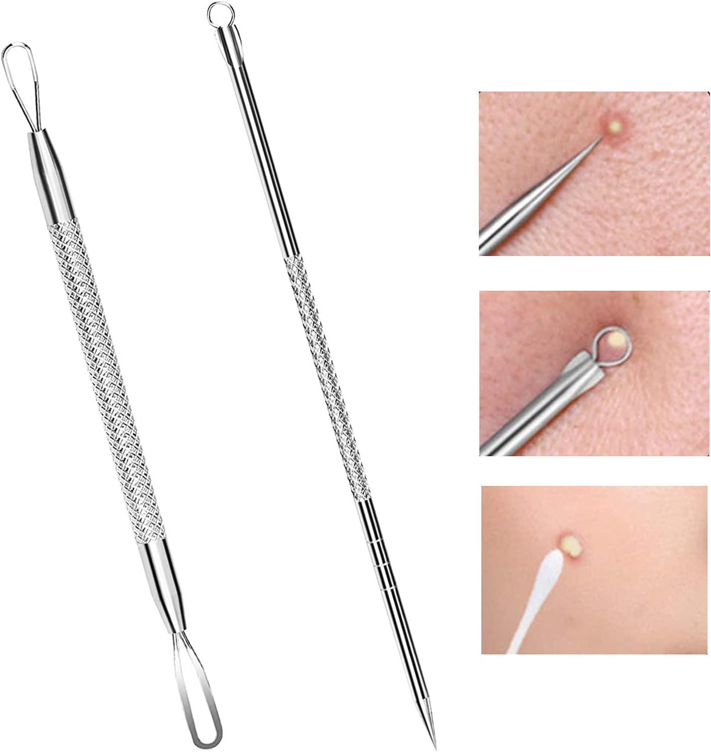 Blackhead Removal Tool atelieryuwa.ciao.jp