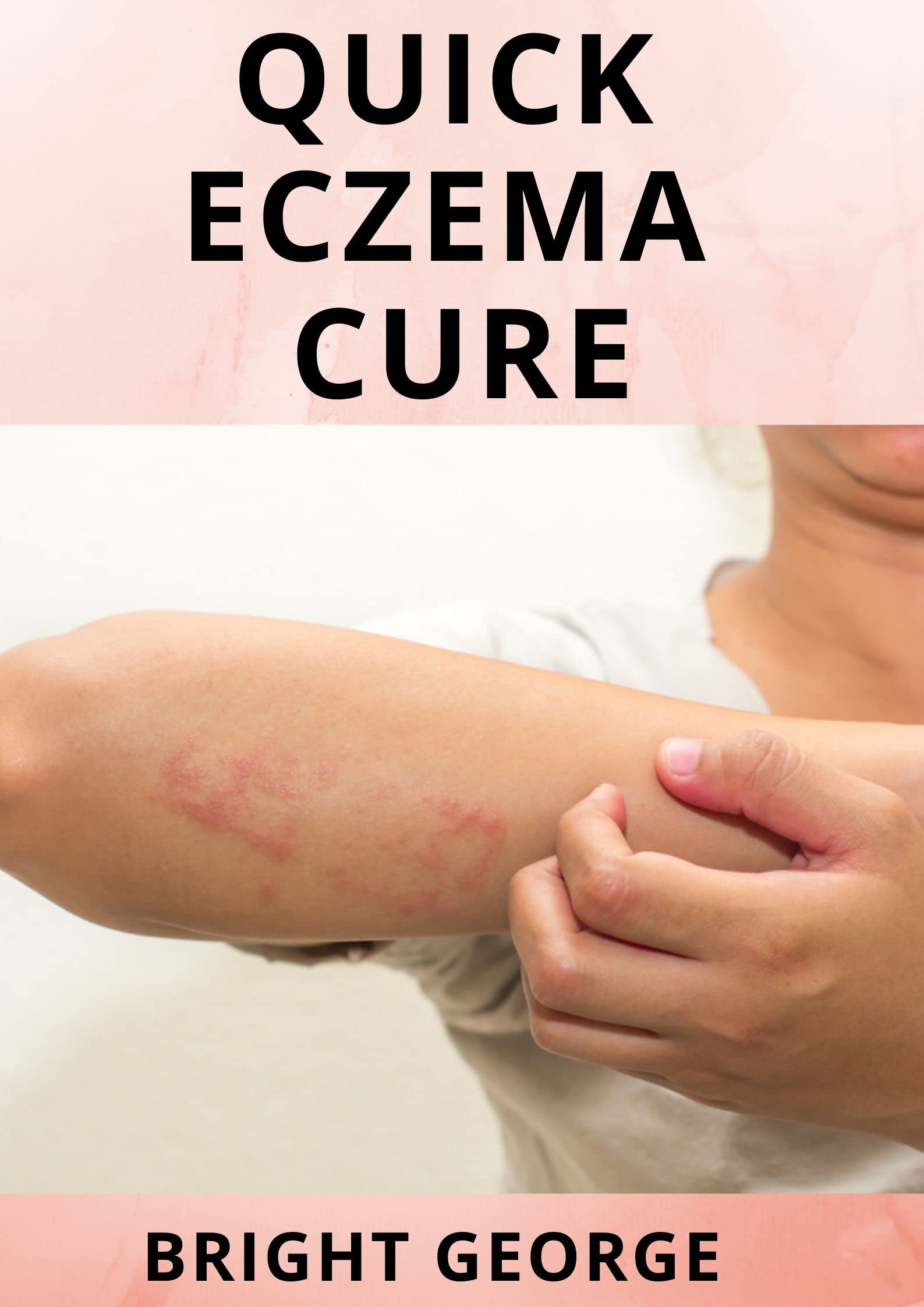 Buy Quick Eczema Cure Natural Eczema To Get Rid Of Skin Problems Once
