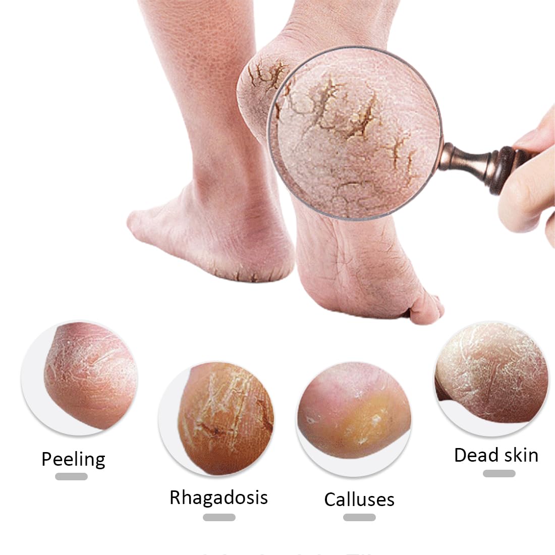 Gel-Fersen-Socken – 3 Paar Zehenlose Spa-Socken Für Trockene, Rissige Fersen, Belüftet Und Feuchtigkeitsspendend