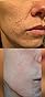 Natrulo Pyrithione Zinc Soap Bar for Face & Body, 4oz | 2% ZnP Bar Soap Skin Repair Cleanser for Acne, Rosacea, Eczema, Dermatitis, Psoriasis, Itching | Cleansing, Calming Zinc Facial Wash Made in USA