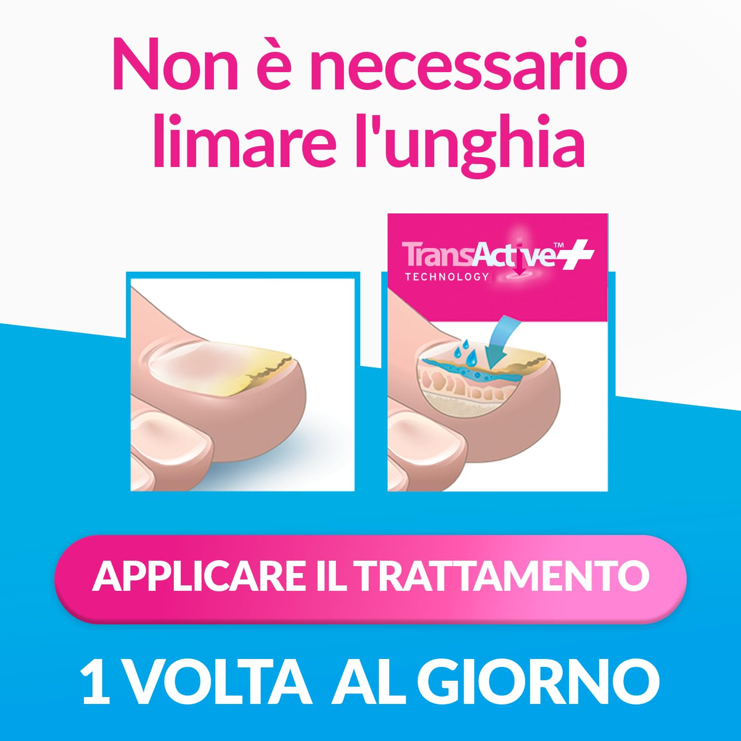 Excilor Micosi dell’unghia Forte, Trattamento della Micosi dell'Unghia Attivo Contro le micosi Persistenti, Confezione da 30 ml