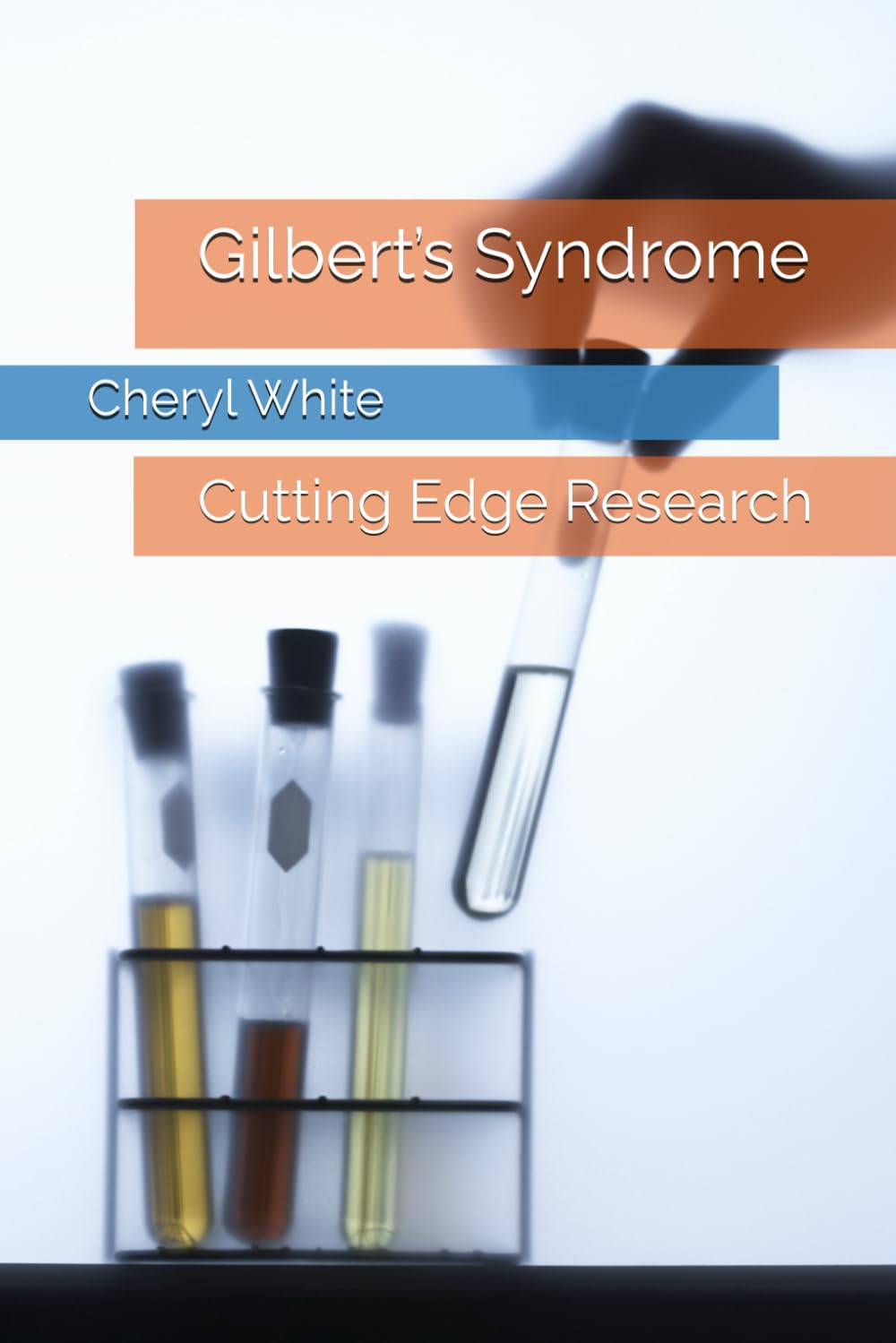 Gilbert’s Syndrome: Cutting Edge Research