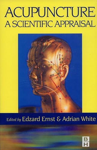 Acupuncture: Acupuncture - Edzard Ernst MD  PhD  FRCP  FRCPED
