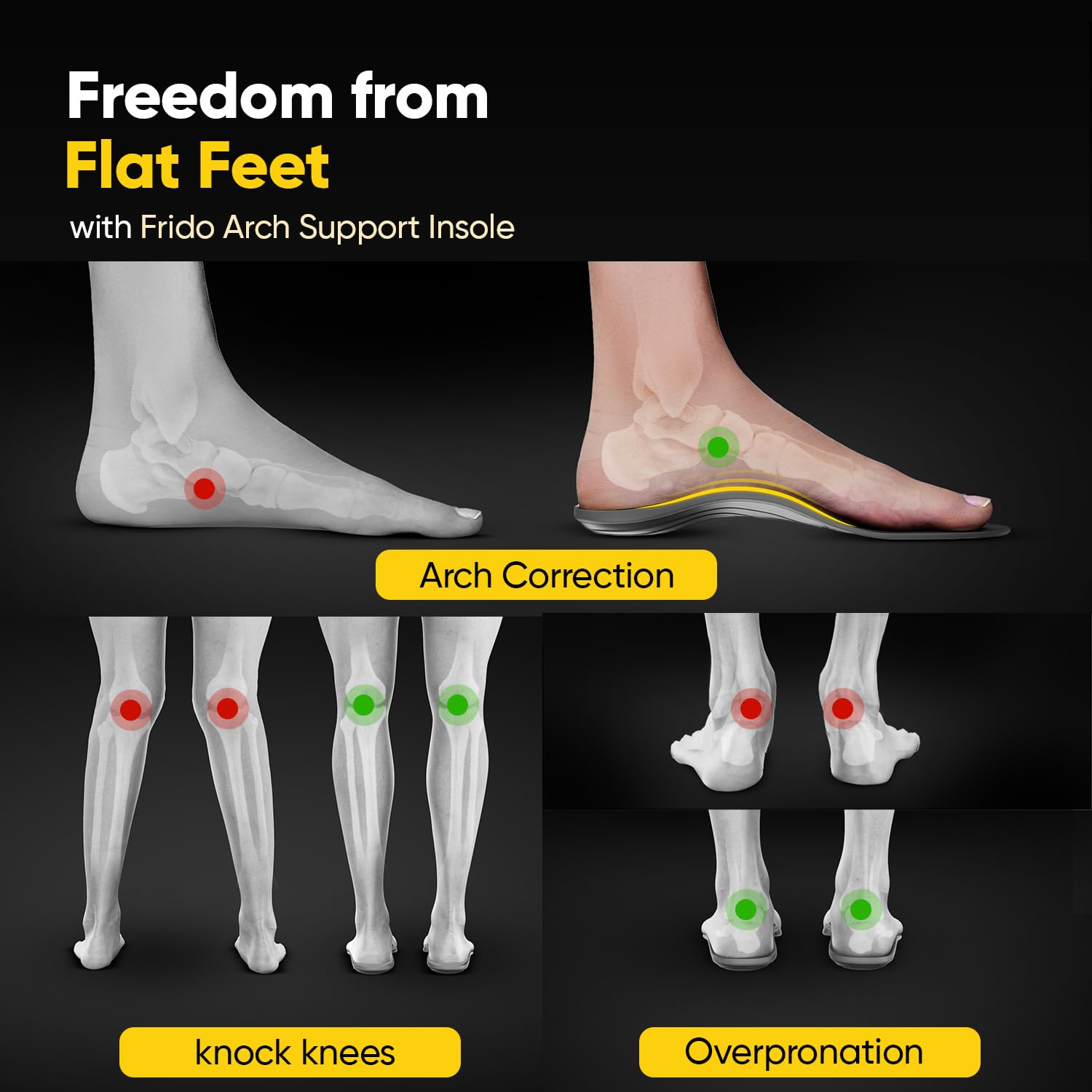 Frido Rigid & Semi Rigid Arch Support Insole for Flat Feet | Relieves Feet Pain | Plantar Fasciitis & Heel Spurs | Orthotic Inserts for Stability | Trimmable Shoe Inserts | Large 9-11 UK | Pack of 2 3