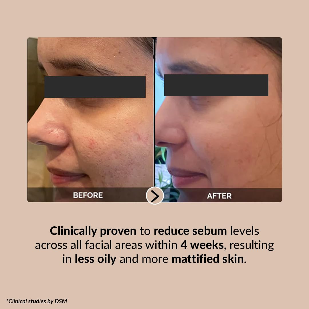 LuxaDerme Korean Pore Perfecting Face Serum with Lotus Water