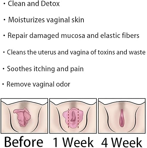 Miniatura 7 de Dexca Natural - Cápsulas vagianales de reparación natural, cápsulas vagianas Aafg Vag, Dexcara, cápsulas de reparación de desintoxicación Dexcara,