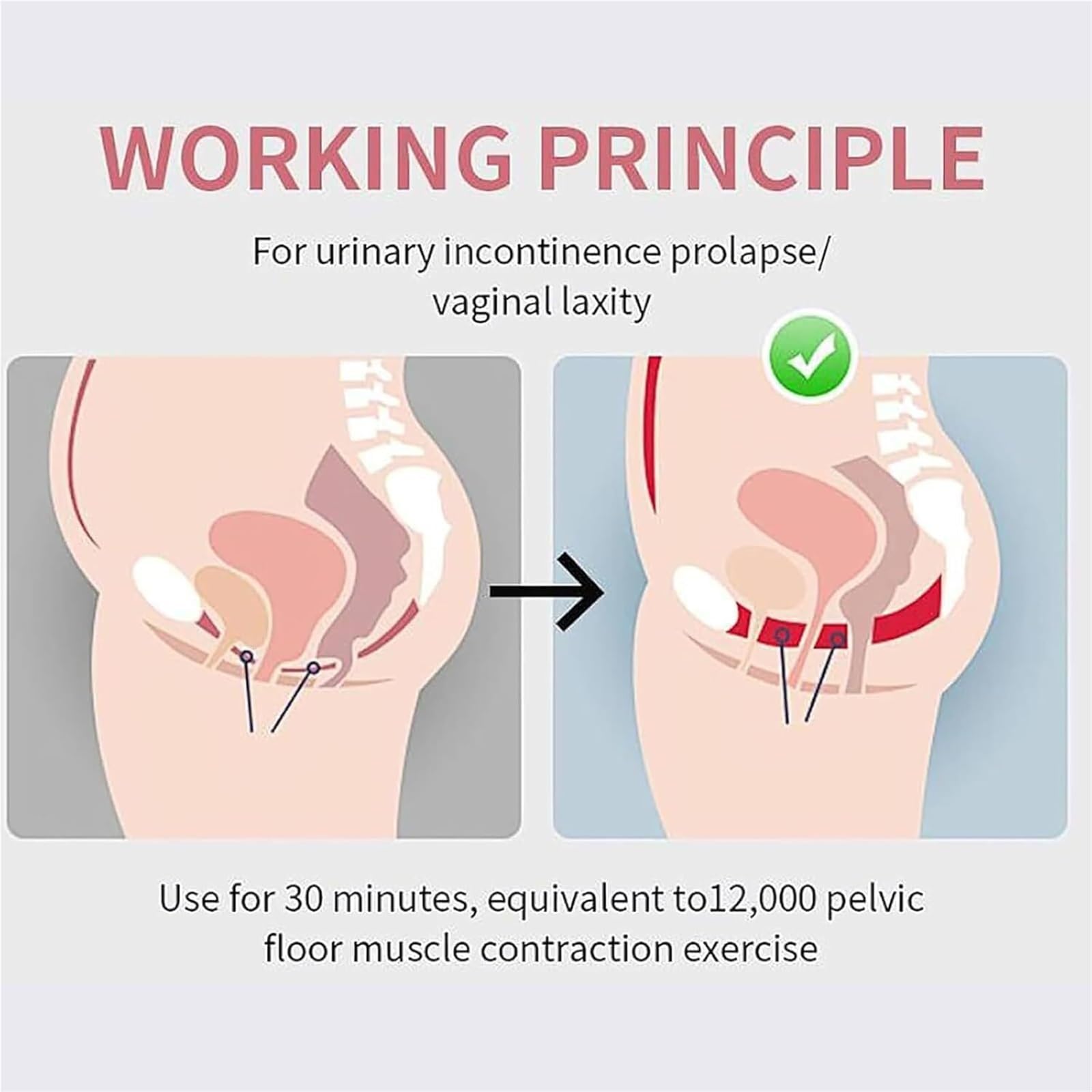 Generico Dispositivo Elettrico per Muscoli Pelvici, Post Parto, 4.300 Vibrazioni/Sec, 12.000 Contrazioni in 30 Minuti, Rafforza Il Pavimento Pelvico