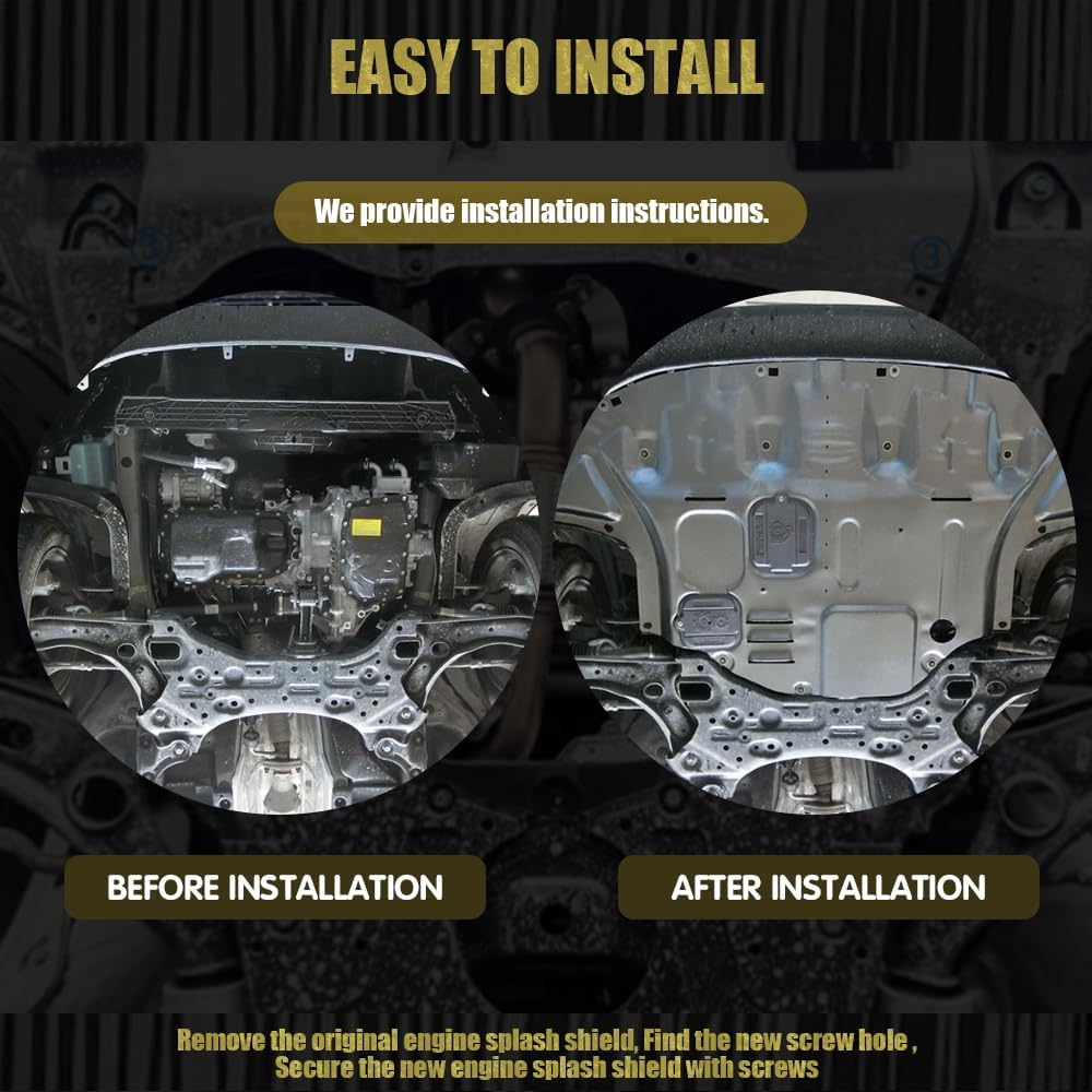 Engine Splash Shield Fit for Kia Forte 2019 2020 2021 2022 2023 Lower Engine Case Guard Under Engine Cover Fit for Forte Front Engine Guard Mud Flaps Including Screw Hardware