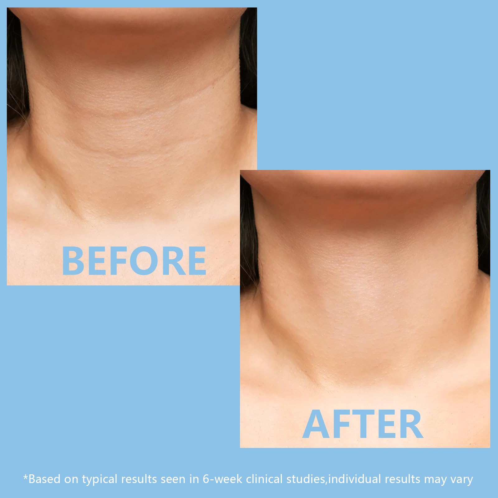 KISSIO 5% Collagen Complex Neck Cream,Neck Tightening Cream with Peptides and Aloe Vera to Firming,Lifting and Hydrating,Body Cream,Suitable for All Skin Types,60 g - Image 4