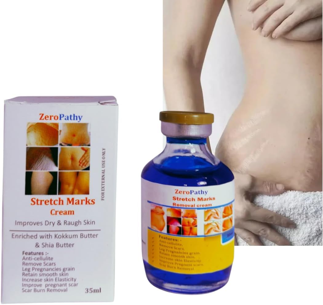 Burn scar clear cream for face body old scars accident scar injury scar injury spots pimple marks for men women. with Aloe Vera Scar Lighte for Burns & Acne Essential Body Cream 35ml