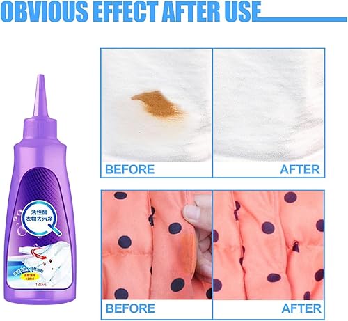 Miniatura 5 de Active Enzyme - Quitamanchas para ropa, removedor de manchas de ropa con enzimas activas, limpieza enzimática activa, limpiador de manchas
