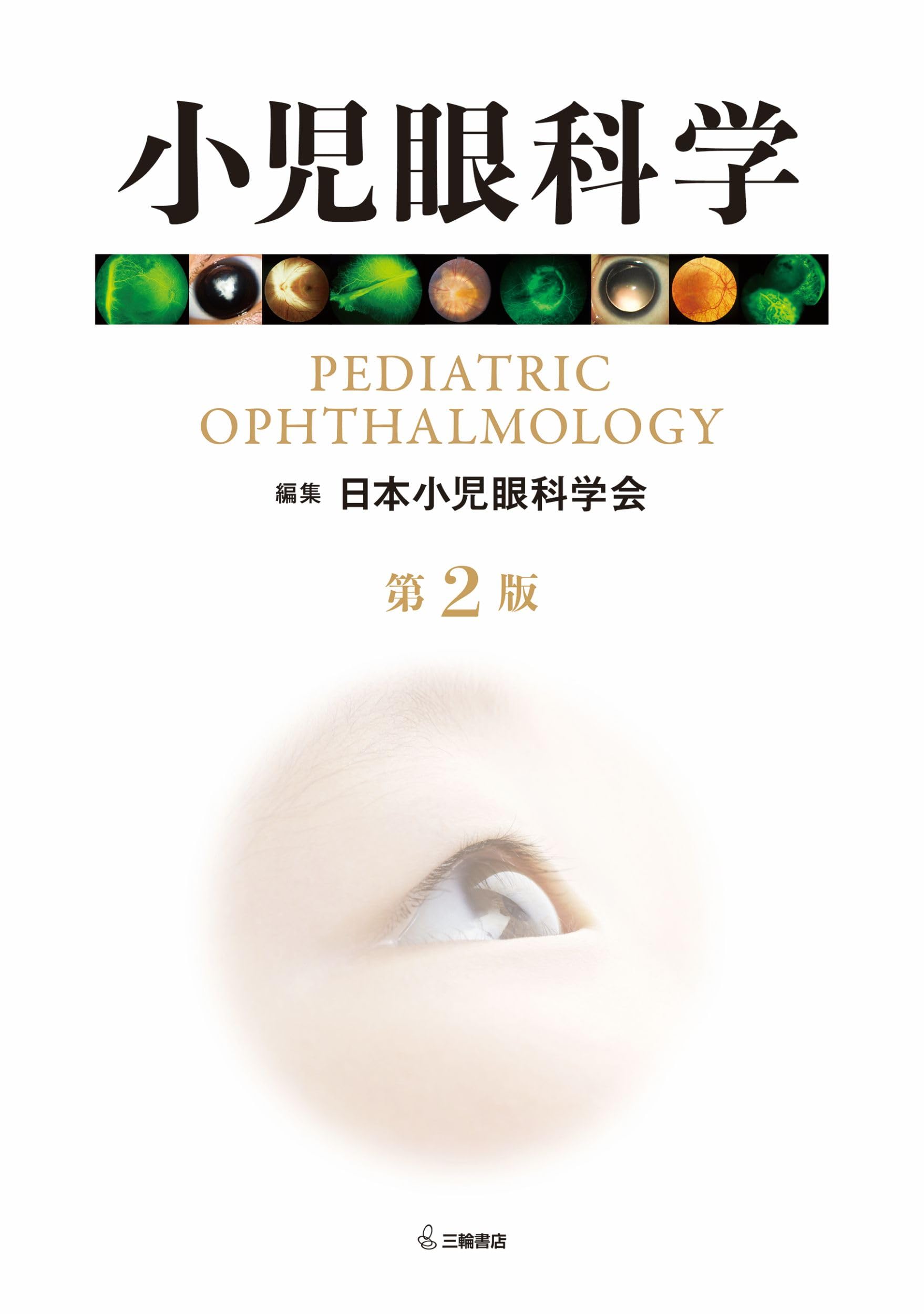 小児眼科学 第2版 | 日本小児眼科学会 |本 | 通販 | Amazon