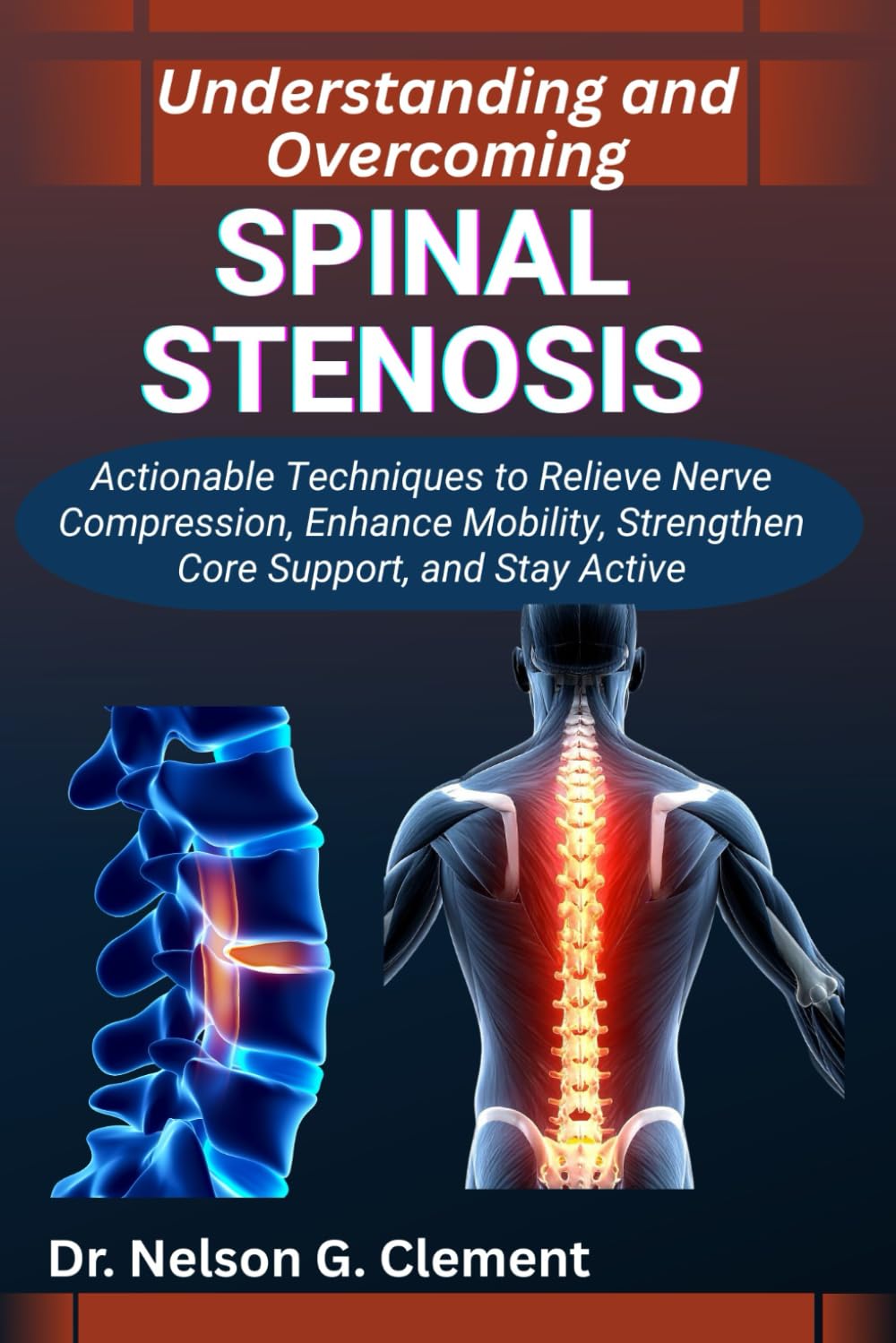 UNDERSTANDING AND OVERCOMING SPINAL STENOSIS: Actionable Techniques to Relieve Nerve Compression, Enhance Mobility, Strengthen Core Support, and Stay Active